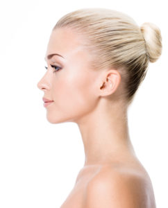 Woman with beautiful profile after skin tightening laser treatment