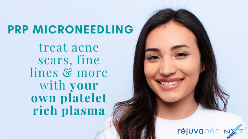 graphic showing benefits of prp microneedling with young woman smiling