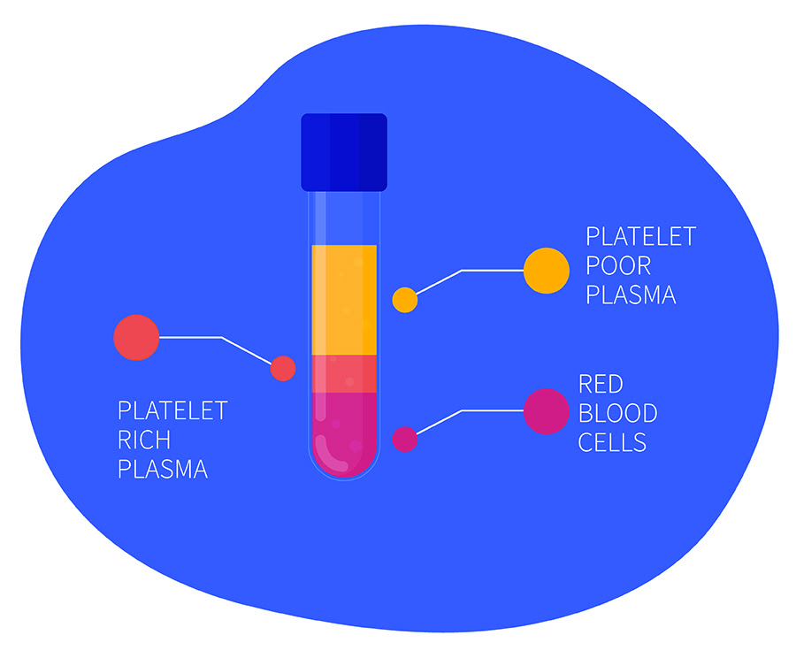 design showing test tube containing prp and separated blood components